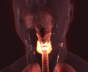 X-ray image of a person with thyroid issues that could potentially lead to thyroid cancer.